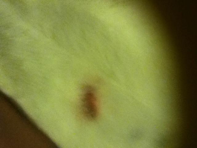 Wound on Justin\'s belly